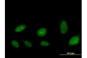 Immunofluorescence of purified MaxPab antibody to ATAD2 on HeLa cell. (ATAD2 anticorps  (AA 1-362))