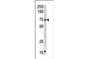 Image no. 1 for anti-Carnitine Palmitoyltransferase 2 (CPT2) (C-Term) antibody (ABIN357771) (CPT2 anticorps  (C-Term))