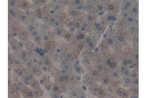 Detection of ITGb5 in Mouse Liver Tissue using Polyclonal Antibody to Integrin Beta 5 (ITGb5)