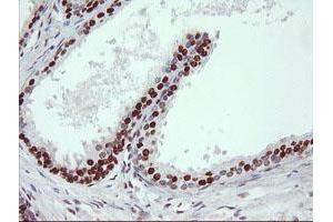 anti-Tripartite Motif Containing 38 (TRIM38) (AA 1-265) antibody