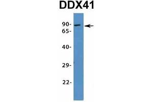 Host:  Rabbit  Target Name:  DDX41  Sample Type:  Human Adult Placenta  Antibody Dilution:  1. (DDX41 anticorps  (N-Term))