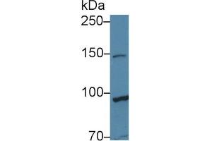 Western Blot; Sample: Human Hela cell lysate; Primary Ab: 1µg/ml Rabbit Anti-Human TAF2 Antibody Second Ab: 0.