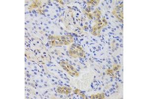 Immunohistochemistry of paraffin-embedded rat kidney using TSC22D3 Antibody.