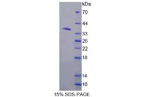 SDS-PAGE (SDS) image for Nucleoside Phosphorylase (NP) (AA 1-286) protein (His tag) (ABIN4989456)