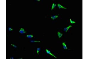 Immunofluorescence staining of SH-SY5Y cells with ABIN7143610 at 1:140, counter-stained with DAPI. (AKTIP anticorps  (AA 1-292))