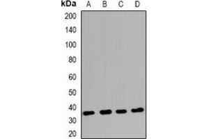 Western blot analysis of Claudin 17 expression in Raji (A), BT474 (B), K562 (C), mouse hrart (D) whole cell lysates. (Claudin 17 anticorps  (C-Term))