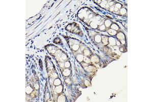 Immunohistochemistry of paraffin-embedded rat testis using CDK1 Rabbit mAb (ABIN7266576) at dilution of 1:100 (40x lens).