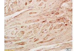 Formalin-fixed and paraffin embedded rat heart tissue labeled Anti-GDF8/MSTN Polyclonal Antibody, Unconjugated (ABIN674469) at 1:200, followed by conjugation to the secondary antibody and DAB staining