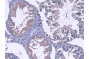 DAB staining on IHC-P; Samples: Mouse Testis Tissue