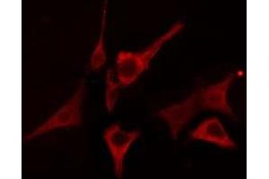 ABIN6276676 staining A549 cells by IF/ICC. (LIPC anticorps  (Internal Region))