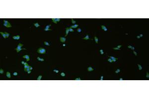 Immunofluorescence analysis of hela cell using SLC18A3 Polyclonal Antibody at dilution of 1:50 (SLC18A3 anticorps)