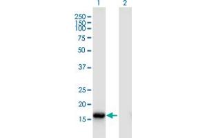 Western Blot analysis of ROBO3 expression in transfected 293T cell line by ROBO3 monoclonal antibody (M02), clone 2H1.