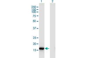 Western Blot analysis of ROBO3 expression in transfected 293T cell line by ROBO3 monoclonal antibody (M02), clone 2H1. (ROBO3 anticorps  (AA 1-147))