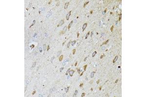 Immunohistochemistry of paraffin-embedded rat brain using MT-ND5 antibody (ABIN6135116, ABIN6144435, ABIN6144437 and ABIN6224158) at dilution of 1:100 (40x lens).