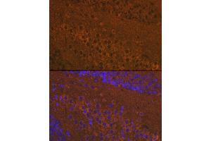 Immunofluorescence analysis of mouse brain using Mu Opioid Receptor(MOR) Rabbit pAb (ABIN7269101) at dilution of 1:100 (40x lens). (Mu Opioid Receptor 1 anticorps  (C-Term))
