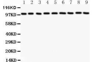 Western Blotting (WB) image for anti-Catenin (Cadherin-Associated Protein), alpha 1, 102kDa (CTNNA1) (AA 143-292) antibody (ABIN3043818) (CTNNA1 anticorps  (AA 143-292))