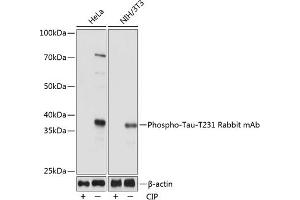 Western blot analysis of extracts of various cell lines, using Phospho-Tau-T231 Rabbit mAb (ABIN7268531) at 1:1000 dilution. (MAPT anticorps  (pThr231))