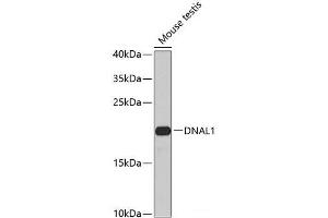 Western blot analysis of extracts of Mouse testis using DNAL1 Polyclonal Antibody at dilution of 1:1000. (DNAL1 anticorps)