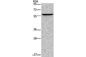 Western blot analysis of Human lung cancer tissue, using ADRA1B Polyclonal Antibody at dilution of 1:550 (ADRA1B anticorps)