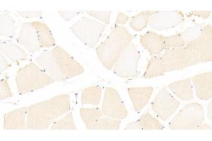 Detection of CCDC80 in Human Skeletal muscle Tissue using Polyclonal Antibody to Coiled Coil Domain Containing Protein 80 (CCDC80)
