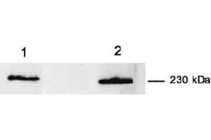 Western Blotting (WB) image for anti-Myoferlin (MYOF) antibody (ABIN1108357) (Myoferlin anticorps)