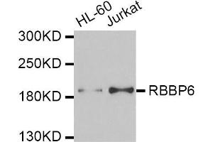 Western blot analysis of extracts of various cell lines, using RBBP6 antibody (ABIN5974190) at 1/1000 dilution. (RBBP6 anticorps)
