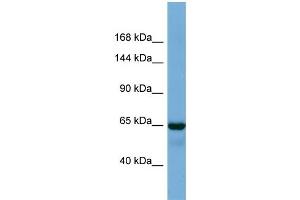Host:  Rabbit  Target Name:  DKFZp686A1782  Sample Type:  Fetal Lung lysates  Antibody Dilution:  1. (PHC1 anticorps  (C-Term))