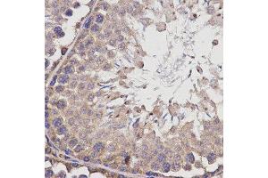 Immunohistochemistry (IHC) image for anti-Butyrylcholinesterase (BCHE) antibody (ABIN1871242) (Butyrylcholinesterase anticorps)