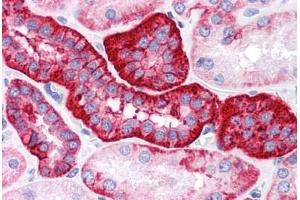 Human Kidney: Formalin-Fixed, Paraffin-Embedded (FFPE) (EpCAM anticorps)