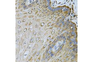 Immunohistochemistry of paraffin-embedded human esophagus using HSP90AB1 Antibody.