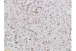 Immunohistochemistry (Paraffin-embedded Sections) (IHC (p)) image for anti-Insulin-Like Growth Factor 1 Receptor (IGF1R) (AA 251-350) antibody (ABIN726575)