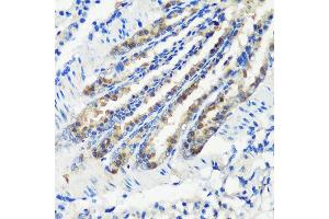 Immunohistochemistry of paraffin-embedded mouse lung using KMT2E antibody (ABIN6131786, ABIN6142983, ABIN6142984 and ABIN6221745) at dilution of 1:200 (40x lens). (MLL5/KMT2E anticorps  (AA 200-500))