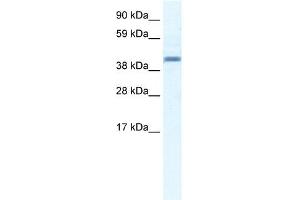 WB Suggested Anti-ANXA7 Antibody Titration:  2.