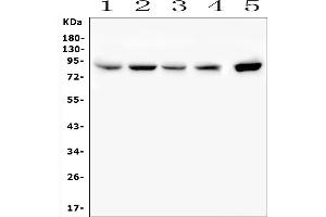 Western blot analysis of SMURF2 using anti-SMURF2 antibody (ABIN7601239). (SMURF2 anticorps  (AA 303-387))