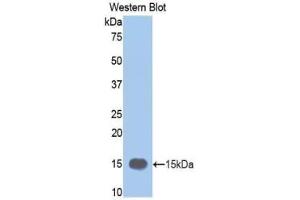 Western blot analysis of the recombinant protein. (MMP12 anticorps  (AA 270-362))
