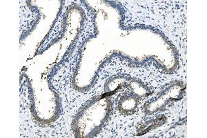 IHC analysis of LPP using anti LPP antibody (ABIN7602831).