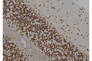 anti-Amyloid beta (A4) Precursor Protein (APP) (C-Term) antibody