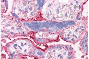 Anti-CTR1 antibody  ABIN960806 IHC staining of human placenta. (SLC31A1 anticorps  (Internal Region))