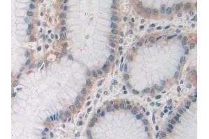 Detection of SIRT4 in Human Stomach Tissue using Polyclonal Antibody to Sirtuin 4 (SIRT4)