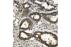 IHC analysis of RPA32/RPA2 using anti-RPA32/RPA2 antibody (ABIN7601380). (RPA2 anticorps  (AA 34-254))