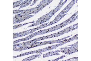 IHC analysis of Integrin alpha 5 using anti-Integrin alpha 5 antibody . (ITGA5 anticorps  (AA 42-263))