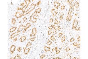 Immunohistochemistry (IHC) image for anti-Replication Protein A2, 32kDa (RPA2) (C-Term) antibody (ABIN7454599) (RPA2 anticorps  (C-Term))