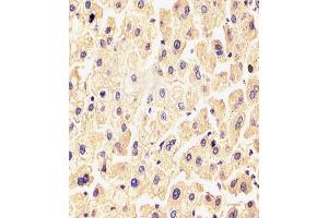(ABIN6243203 and ABIN6577910) staining FGF9 in Human liver tissue sections by Immunohistochemistry (IHC-P - paraformaldehyde-fixed, paraffin-embedded sections). (FGF9 anticorps)