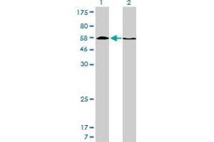 Western Blot analysis of HDAC1 expression in transfected 293T cell line by HDAC1 monoclonal antibody (M14), clone 5C11.