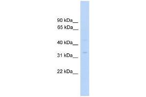 MTFMT antibody used at 0. (MTFMT anticorps  (C-Term))