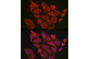 Immunofluorescence analysis of  cells using GART Rabbit pAb (ABIN1679954, ABIN3018225, ABIN3018226 and ABIN6220407) at dilution of 1:200 (40x lens). (GART anticorps  (AA 1-320))