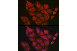 Immunofluorescence analysis of  cells using GART Rabbit pAb (ABIN1679954, ABIN3018225, ABIN3018226 and ABIN6220407) at dilution of 1:200 (40x lens). (GART anticorps  (AA 1-320))