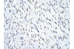 Rabbit Anti-TRIM28 antibody        Paraffin Embedded Tissue:  Human Heart cell   Cellular Data:  Epithelial cells of renal tubule  Antibody Concentration:   4.