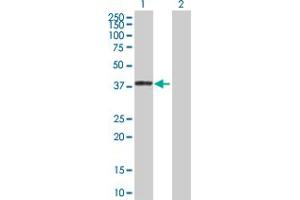 Western Blot analysis of TNK2 expression in transfected 293T cell line by TNK2 MaxPab polyclonal antibody. (TNK2 anticorps  (AA 1-352))