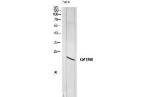 Western Blot (WB) analysis of HeLa lysis using CMTM8 antibody.